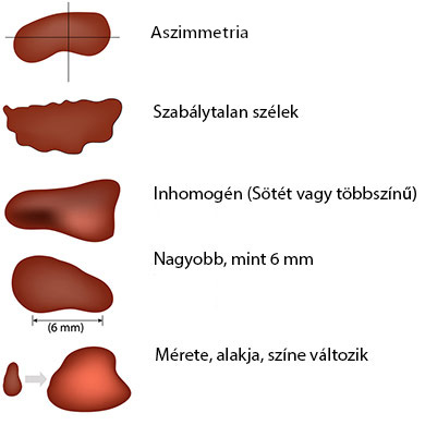 A melanoma jelei