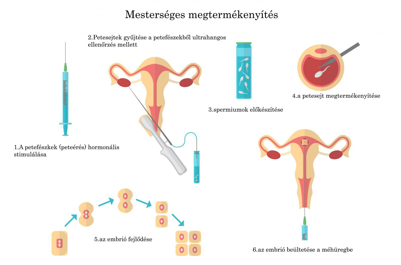Mesterséges megtermékenyítés Mesterséges megtermékenyítés