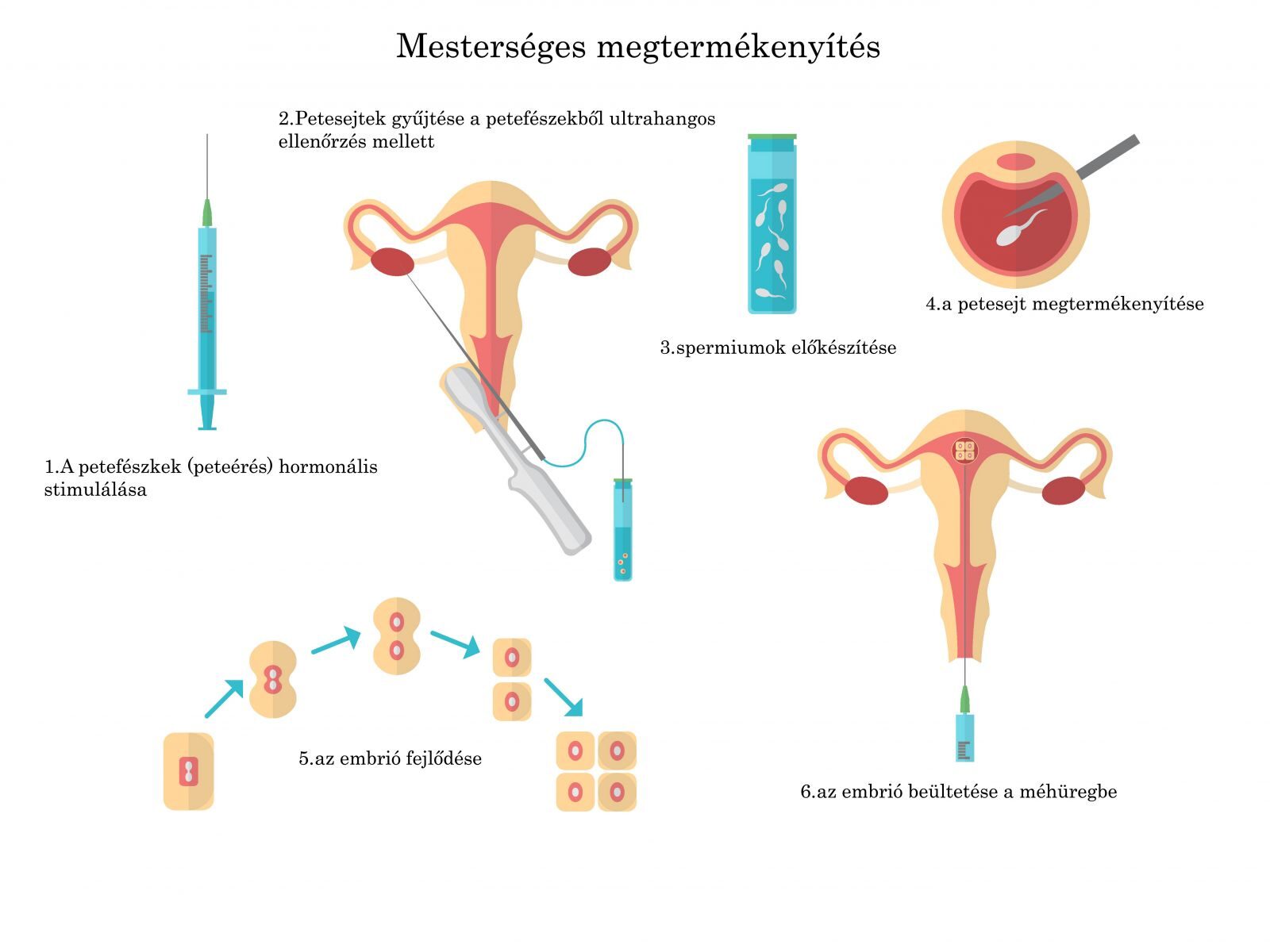 Lombikbébi - egyetlen embrió beültetése hatásosabb