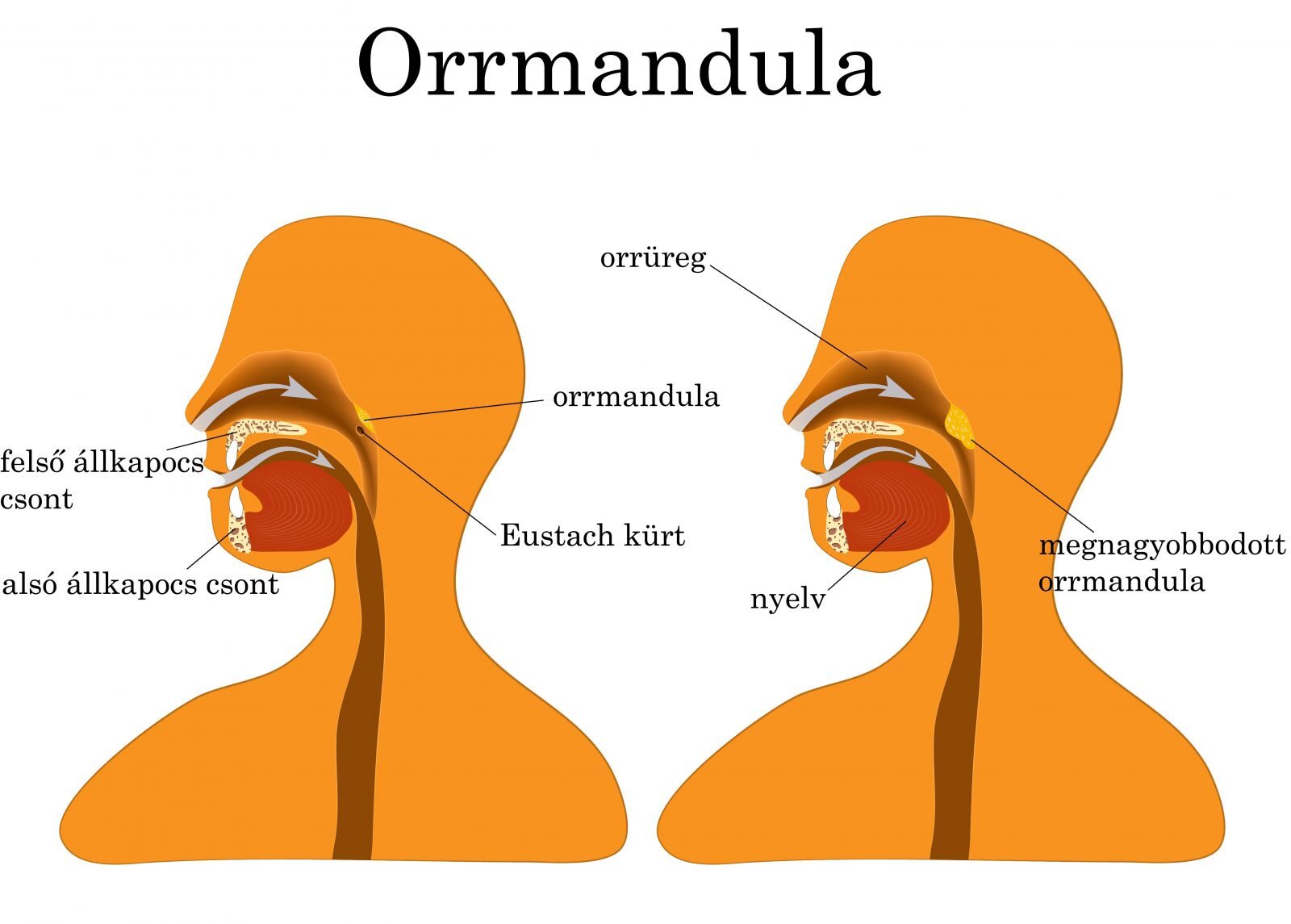 Orrmandula