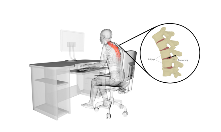 Az ülőmunka hatása a gerincoszlopra