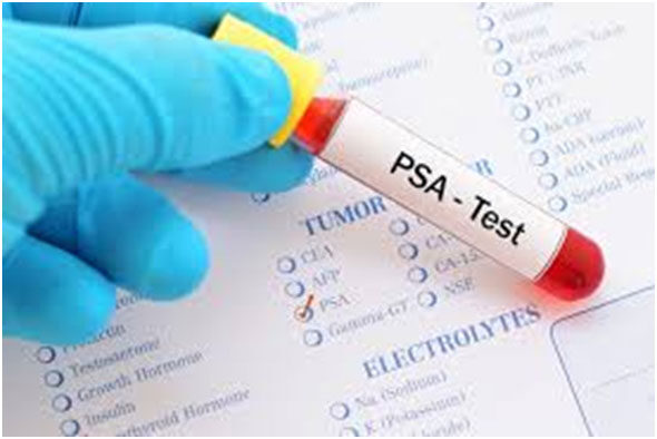 PSA-teszt