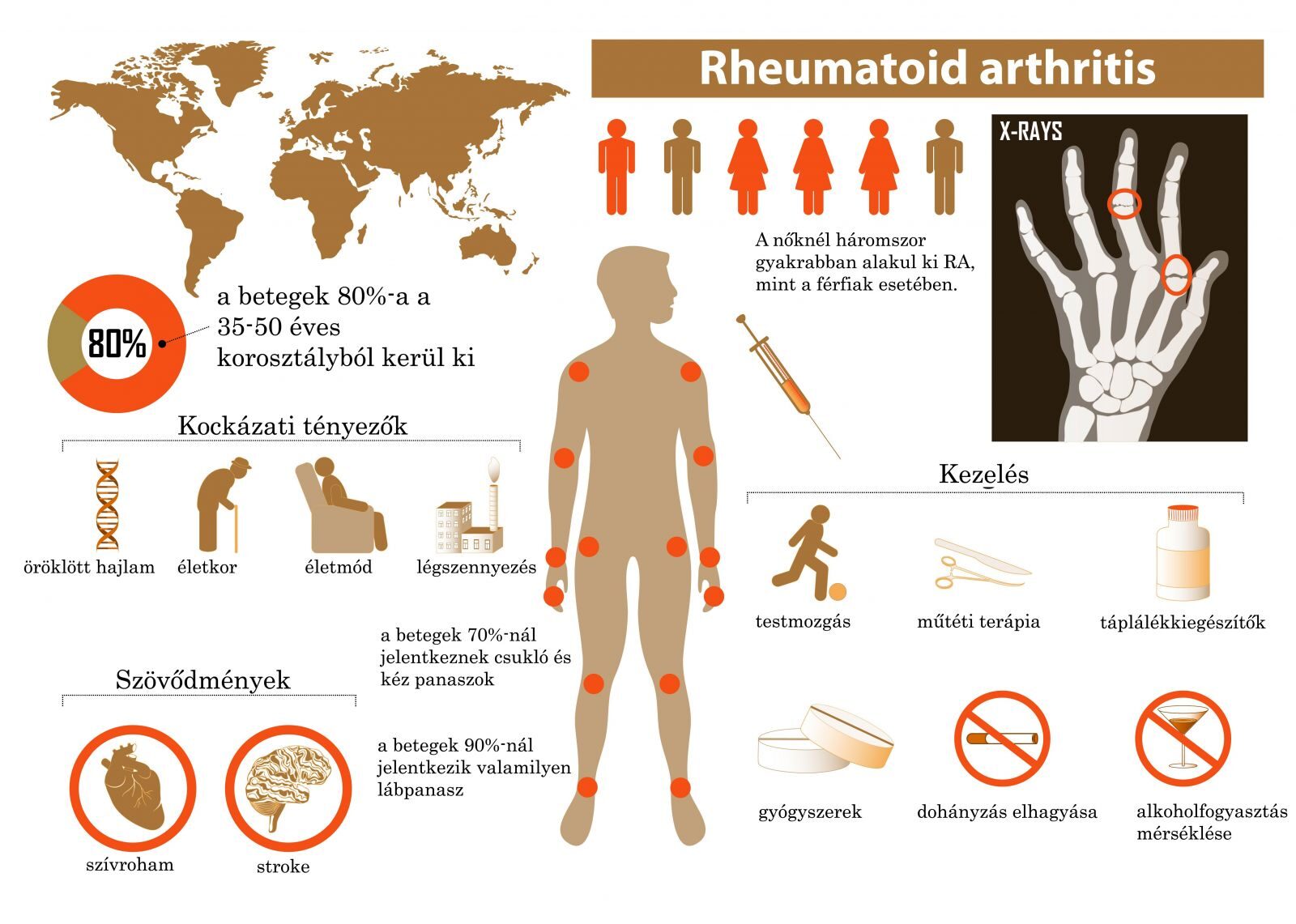 a rheumatoid arthritisben szenvedő beteg kezét
