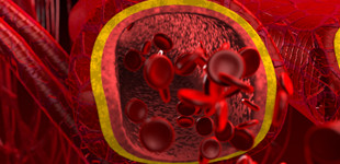 vér reninszintje magas vérnyomásban gyógyszerek magas vérnyomás sartana