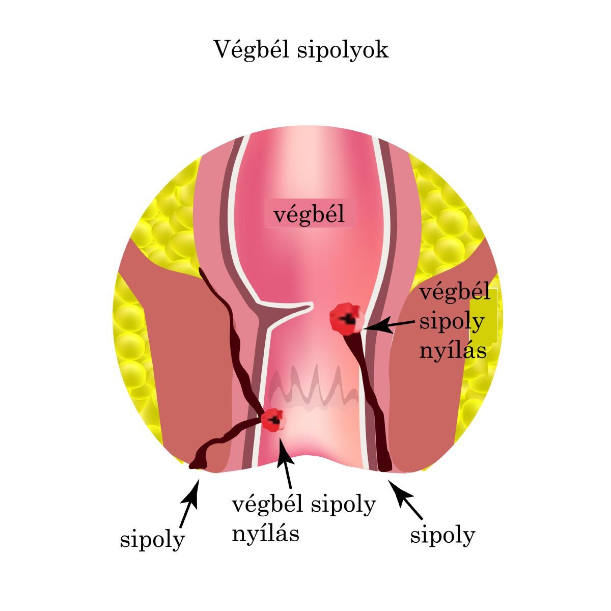 Viszketés végbélnyílás amikor a prostatitis