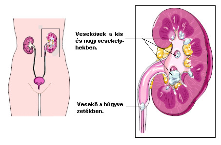 A vesegörcs - jellemző panaszok, lehetséges okok